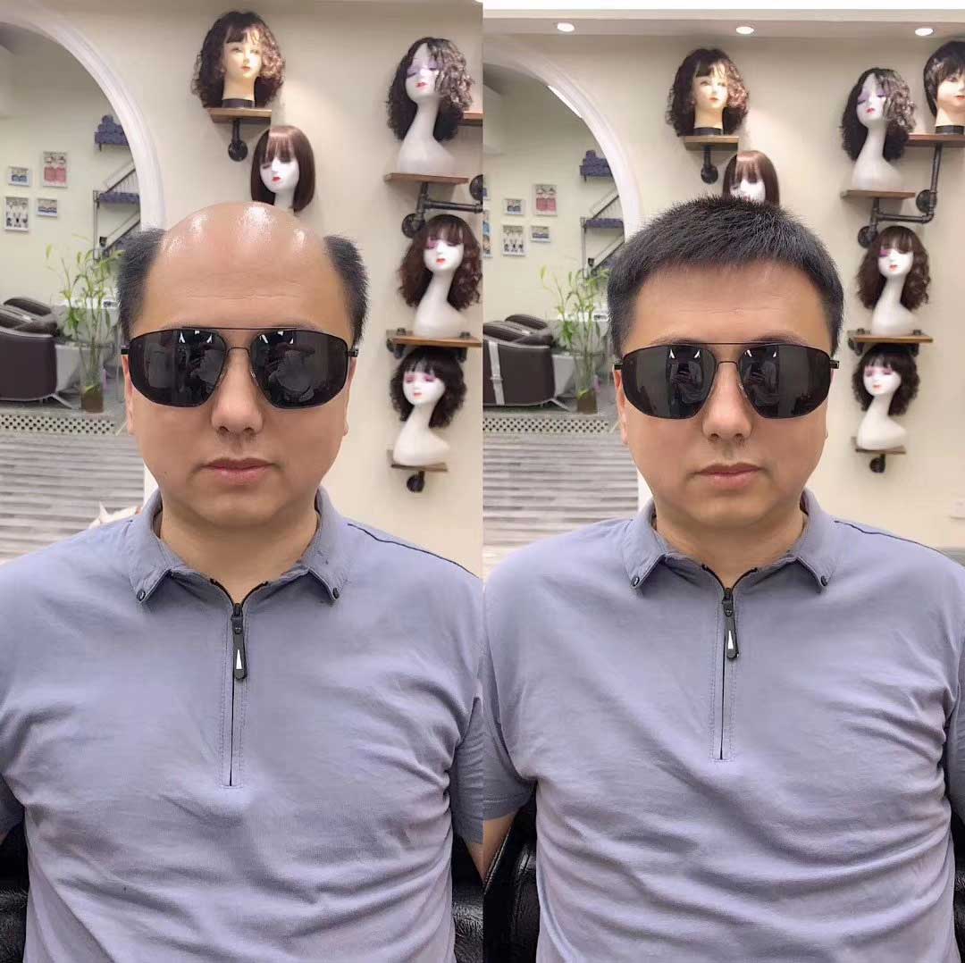 徹底解決掉發(fā)問題，這才是我要的！