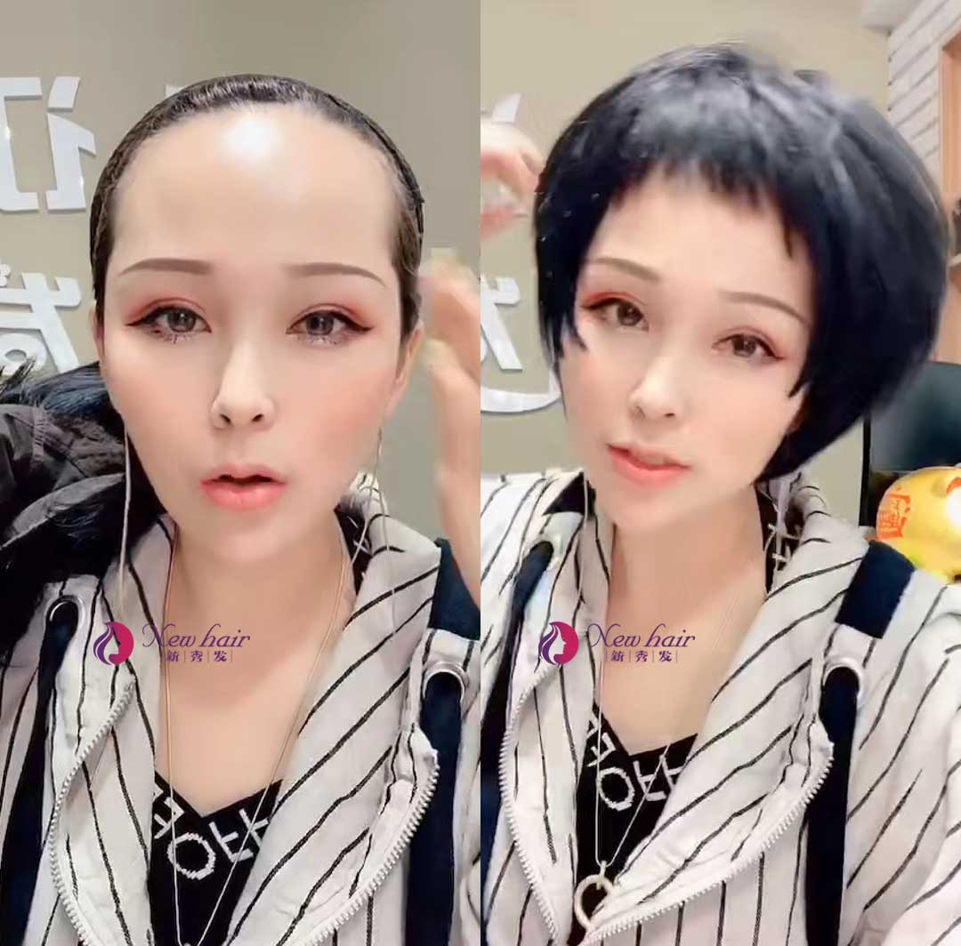怎么佩戴假發(fā)？假發(fā)套價格怎么計算？